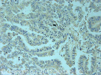 Immunohistochemistry (Formalin/PFA-fixed paraffin-embedded sections) - Anti-PDE6 alpha antibody (AB5659)