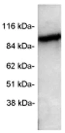 Western blot - Anti-PDE6 alpha antibody (AB5659)