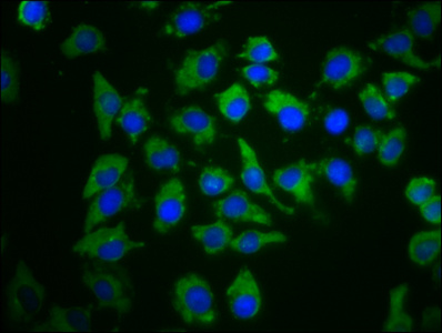 Immunocytochemistry/ Immunofluorescence - Anti-PDE6C antibody (AB236957)