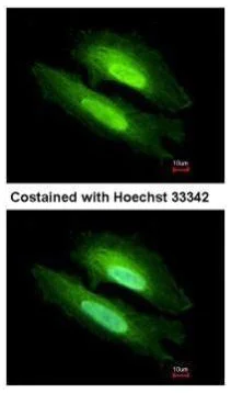 Immunocytochemistry/ Immunofluorescence - Anti-PDE6D antibody (AB96825)