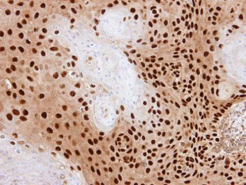 Immunohistochemistry (Formalin/PFA-fixed paraffin-embedded sections) - Anti-PDE6D antibody (AB96825)