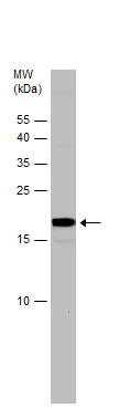 Western blot - Anti-PDE6D antibody (AB96825)