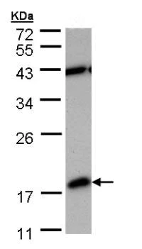 Western blot - Anti-PDE6D antibody (AB96825)