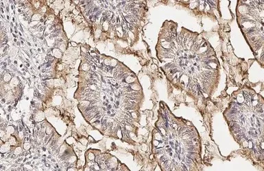 Immunohistochemistry (Formalin/PFA-fixed paraffin-embedded sections) - Anti-PDE6D antibody [HL1359] - BSA and Azide free (AB313845)