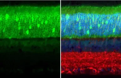 Immunohistochemistry (Formalin/PFA-fixed paraffin-embedded sections) - Anti-PDE6D antibody [HL1359] - BSA and Azide free (AB313845)