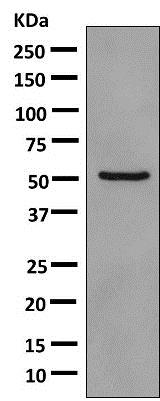 Western blot - Anti-PDE7A/HCP1 antibody [EPR7731] - BSA and Azide free (AB249158), expandable thumbnail