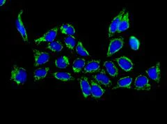 Immunocytochemistry/ Immunofluorescence - Anti-PDE7B antibody [EPR11491] (AB170914)