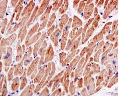Immunohistochemistry (Formalin/PFA-fixed paraffin-embedded sections) - Anti-PDE7B antibody [EPR11491] - BSA and Azide free (AB249586)