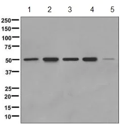 Western blot - Anti-PDE7B antibody [EPR11491] - BSA and Azide free (AB249586)