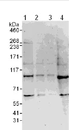 Western blot - Anti-PDE8A antibody (AB109597)