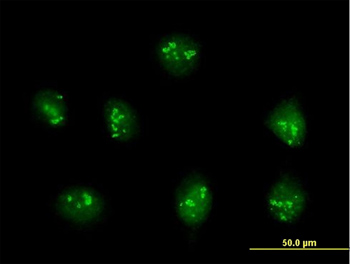 Immunocytochemistry/ Immunofluorescence - Anti-PDE9A antibody (AB168432)