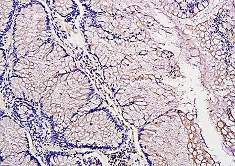 Immunohistochemistry (Formalin/PFA-fixed paraffin-embedded sections) - Anti-PDGF AA antibody (AB216619), expandable thumbnail