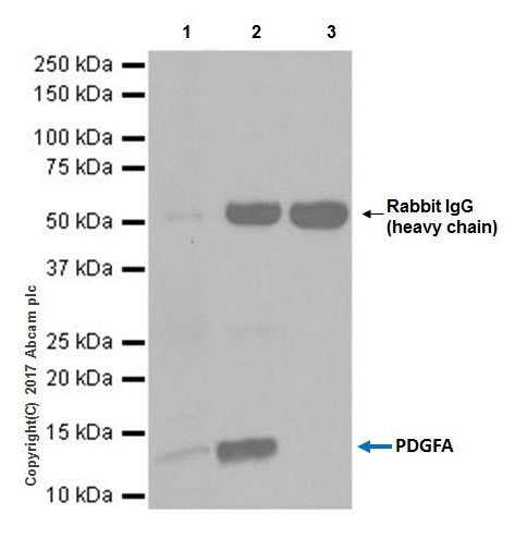 Immunoprecipitation - Anti-PDGF AA antibody [EPR19924] (AB203911), expandable thumbnail