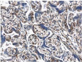 Immunohistochemistry (Formalin/PFA-fixed paraffin-embedded sections) - Anti-PDGF AA antibody [MM0013-6D35] (AB51868), expandable thumbnail
