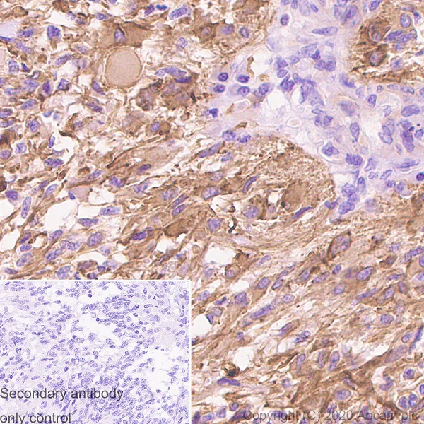Immunohistochemistry (Formalin/PFA-fixed paraffin-embedded sections) - Anti-PDGF B antibody [326A] - BSA and Azide free (AB252808)