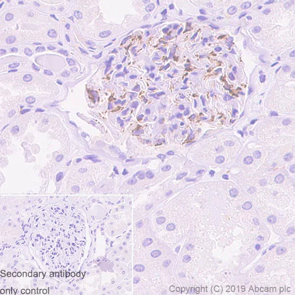 Immunohistochemistry (Formalin/PFA-fixed paraffin-embedded sections) - Anti-PDGF B antibody [326A] - BSA and Azide free (AB252808)
