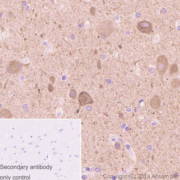 Immunohistochemistry (Formalin/PFA-fixed paraffin-embedded sections) - Anti-PDGF B antibody [326A] - BSA and Azide free (AB252808)
