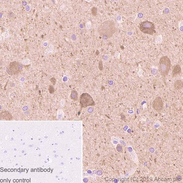 Immunohistochemistry (Formalin/PFA-fixed paraffin-embedded sections) - Anti-PDGF B antibody [326A] - BSA and Azide free (AB252808)