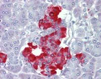 Immunohistochemistry (Formalin/PFA-fixed paraffin-embedded sections) - Anti-PDGF B antibody (AB111310)