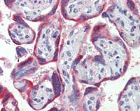 Immunohistochemistry (Formalin/PFA-fixed paraffin-embedded sections) - Anti-PDGF B antibody (AB111310)