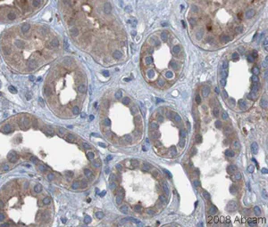 Immunohistochemistry (Formalin/PFA-fixed paraffin-embedded sections) - Anti-PDGF B antibody (AB23914)