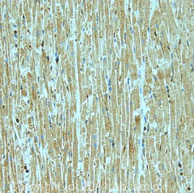 Immunohistochemistry (Formalin/PFA-fixed paraffin-embedded sections) - Anti-PDGF B antibody (AB23914)