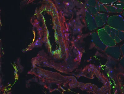 Immunohistochemistry (Formalin/PFA-fixed paraffin-embedded sections) - Anti-PDGF B antibody (AB23914)