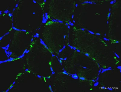 Immunohistochemistry (Formalin/PFA-fixed paraffin-embedded sections) - Anti-PDGF B antibody (AB23914)