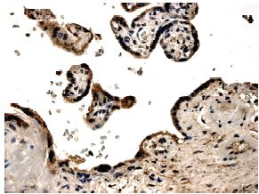 Immunohistochemistry (Formalin/PFA-fixed paraffin-embedded sections) - Anti-PDGF B antibody [MM0014-5F66] (AB51869)