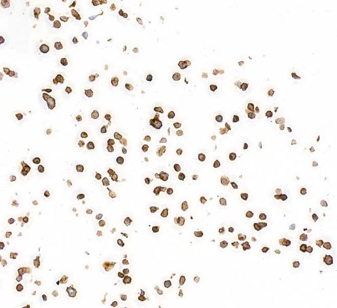 Immunocytochemistry - Anti-PDGFR alpha antibody [BLR128H] - BSA free (AB314105)