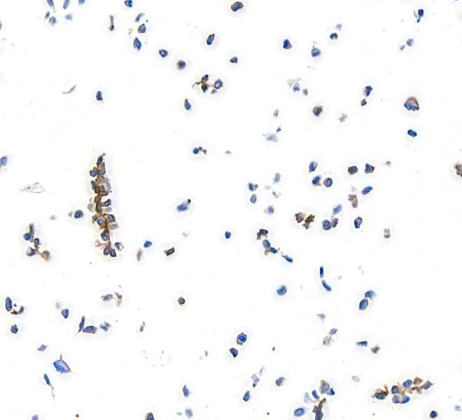 Immunocytochemistry - Anti-PDGFR alpha antibody [BLR128H] - BSA free (AB314105)