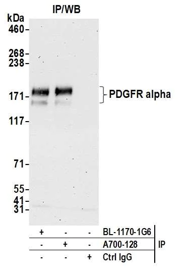 Immunoprecipitation - Anti-PDGFR alpha antibody [BLR128H] - BSA free (AB314105)