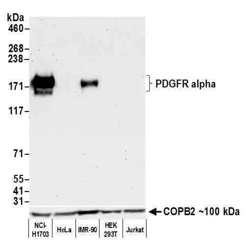 Western blot - Anti-PDGFR alpha antibody [BLR128H] - BSA free (AB314105)
