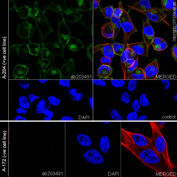 Immunocytochemistry/ Immunofluorescence - Anti-PDGFR alpha antibody [EPR22059-270] (ab203491), expandable thumbnail