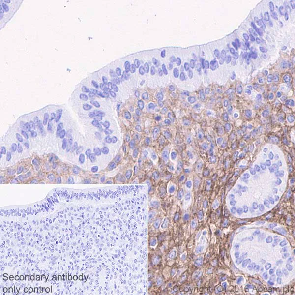 Immunohistochemistry (Formalin/PFA-fixed paraffin-embedded sections) - Anti-PDGFR alpha antibody [EPR22059-270] (AB203491)