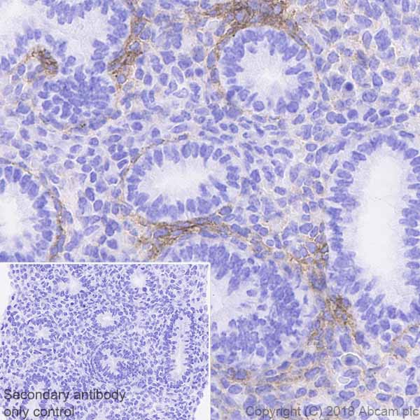Immunohistochemistry (Formalin/PFA-fixed paraffin-embedded sections) - Anti-PDGFR alpha antibody [EPR22059-270] (ab203491), expandable thumbnail