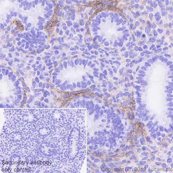 Immunohistochemistry (Formalin/PFA-fixed paraffin-embedded sections) - Anti-PDGFR alpha antibody [EPR22059-270] (AB203491)