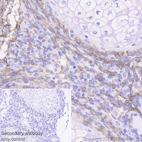 Immunohistochemistry (Formalin/PFA-fixed paraffin-embedded sections) - Anti-PDGFR alpha antibody [EPR22059-270] (ab203491), expandable thumbnail