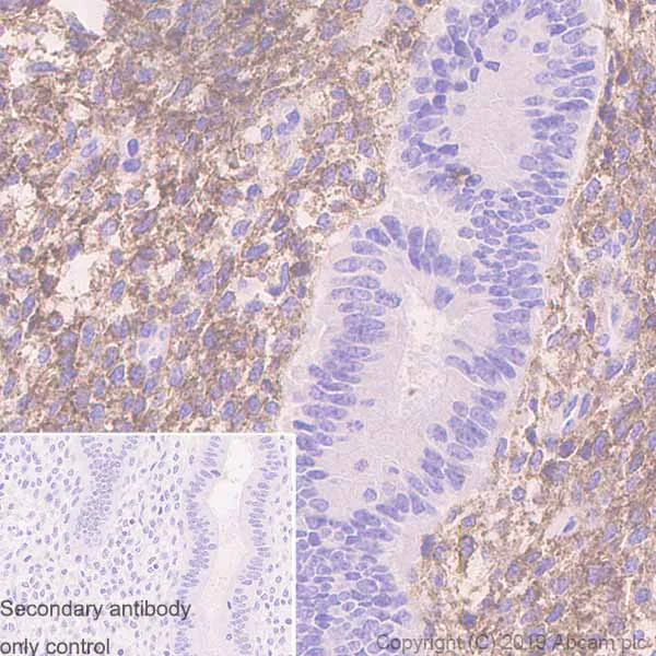 Immunohistochemistry (Formalin/PFA-fixed paraffin-embedded sections) - Anti-PDGFR alpha antibody [EPR22059-270] (AB203491)