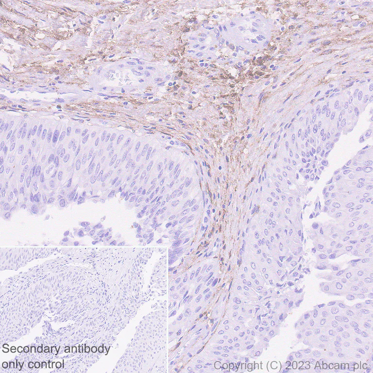 Anti-PDGFR alpha antibody [EPR22059-270] KO tested (ab203491) Abcam