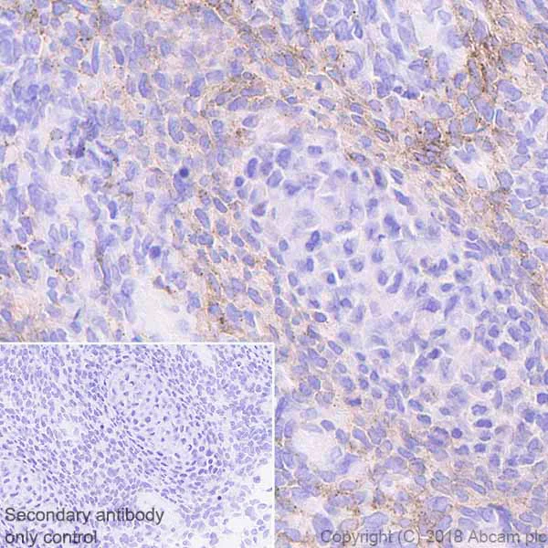 Immunohistochemistry (Formalin/PFA-fixed paraffin-embedded sections) - Anti-PDGFR alpha antibody [EPR22059-270] (AB203491)