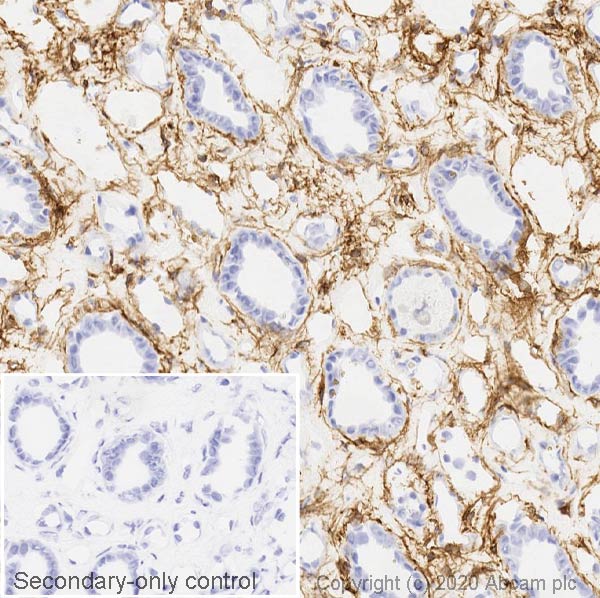 Immunohistochemistry (Frozen sections) - Anti-PDGFR alpha antibody [EPR22059-270] (ab203491), expandable thumbnail