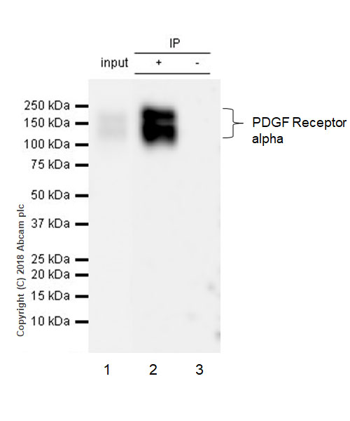 Immunoprecipitation - Anti-PDGFR alpha antibody [EPR22059-270] (AB203491), expandable thumbnail