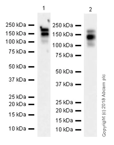 Western blot - Anti-PDGFR alpha antibody [EPR22059-270] (AB203491)