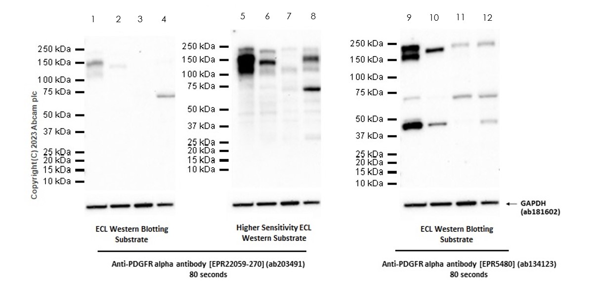 Western blot - Anti-PDGFR alpha antibody [EPR22059-270] (ab203491), expandable thumbnail