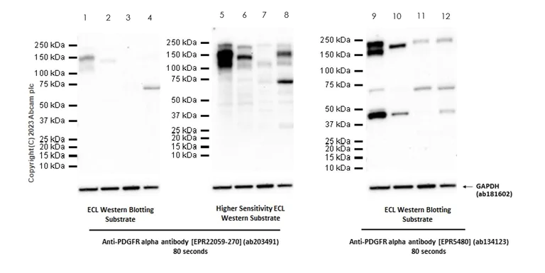 Western blot - Anti-PDGFR alpha antibody [EPR22059-270] (AB203491)