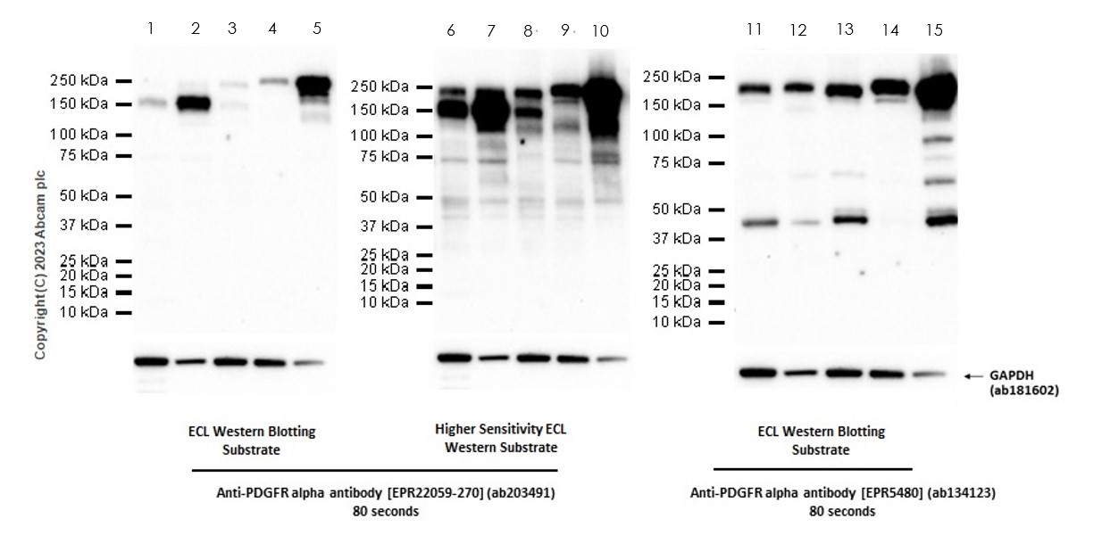 Western blot - Anti-PDGFR alpha antibody [EPR22059-270] (ab203491), expandable thumbnail