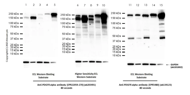 Western blot - Anti-PDGFR alpha antibody [EPR22059-270] (AB203491)