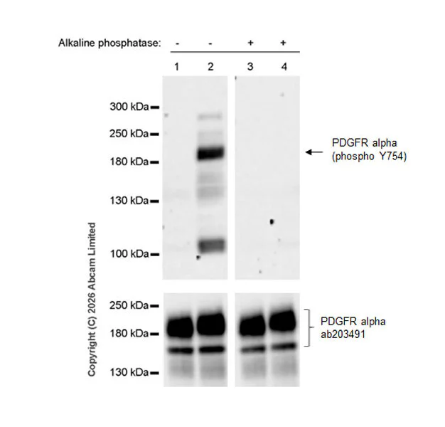 Western blot - Anti-PDGFR alpha antibody [EPR22059-270] (AB203491)