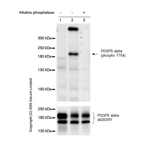 Western blot - Anti-PDGFR alpha antibody [EPR22059-270] (AB203491)